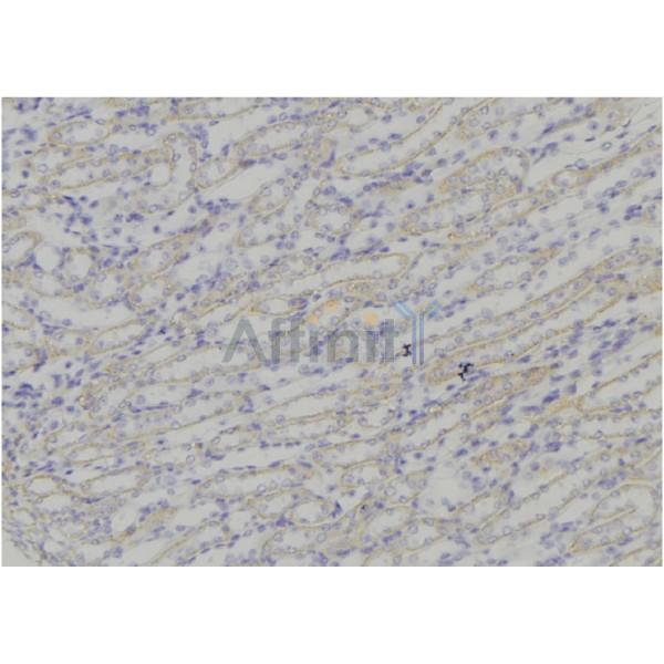 Валидация Affinity DF9038 - 21282