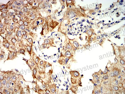 Валидация AntibodySystem RHC99303 (1237)