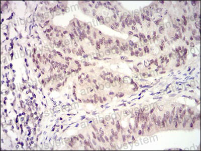 Валидация AntibodySystem RHC90504