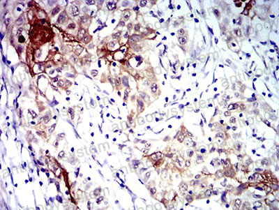 Валидация AntibodySystem RHE67902