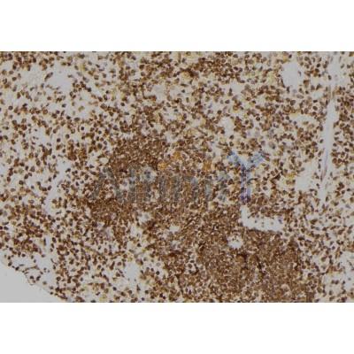 Валидация Affinity DF6307 - 17626