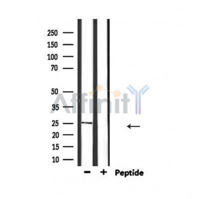 Валидация Affinity AF5139 - 2528