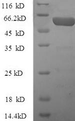 SDS-PAGE