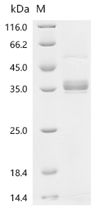 SDS-PAGE
