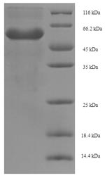 SDS-PAGE