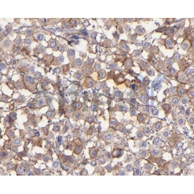 Валидация Affinity AF5152 - 2549