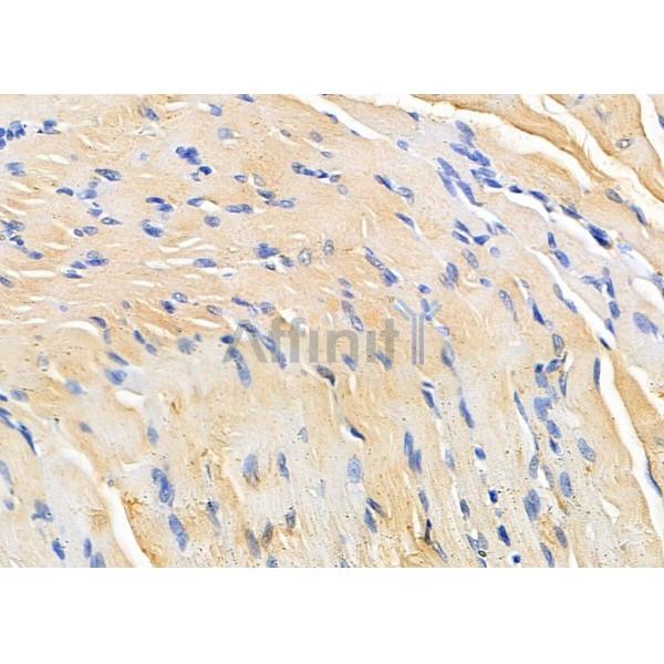 Валидация Affinity DF8794 - 20829