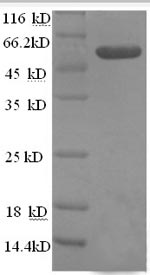 SDS-PAGE