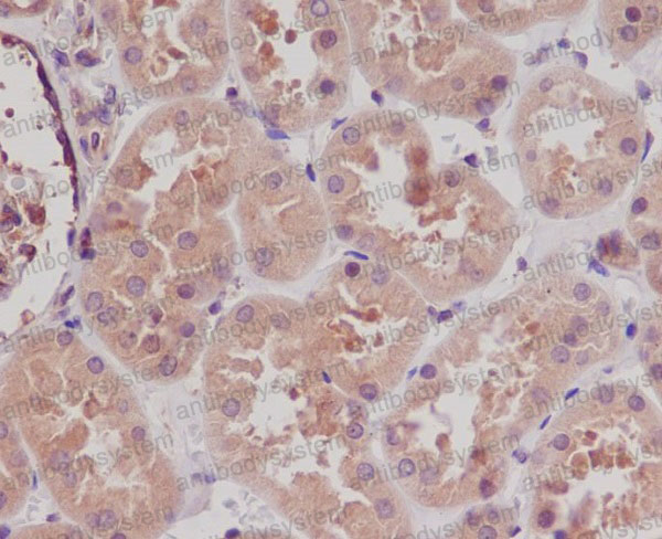 Валидация AntibodySystem RHG43502