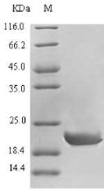 SDS-PAGE