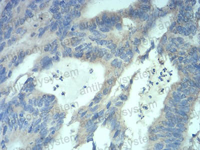 Валидация AntibodySystem RHE84004