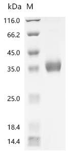 SDS-PAGE