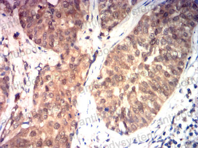 Валидация AntibodySystem RHE05805 (1942)