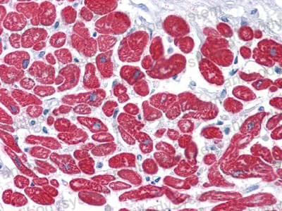 Валидация AntibodySystem RHC34501