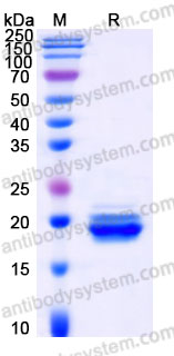 EHE86301, SDS-PAGE