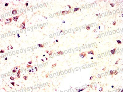 Валидация AntibodySystem RHD71002 (1742)