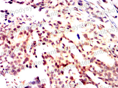 Валидация AntibodySystem RHF94401 (2740)