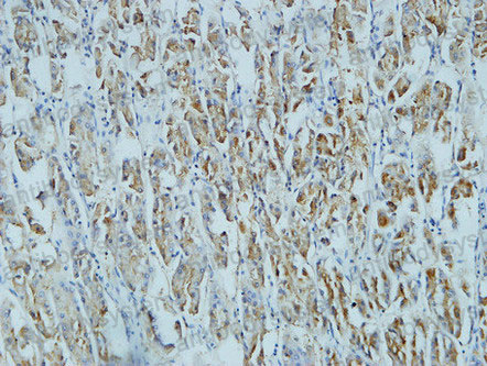 Валидация AntibodySystem RHD50005