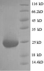 SDS-PAGE