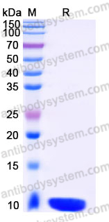 YHH21702, SDS-PAGE