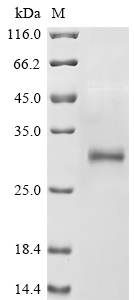 SDS-PAGE