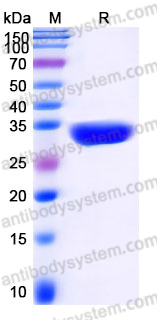 YHJ98702, SDS-PAGE