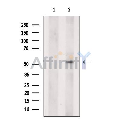 Валидация Affinity DF13345 - 8545