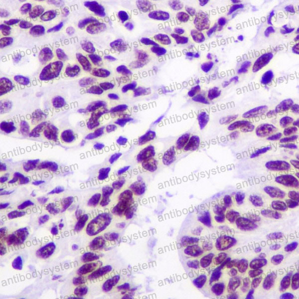 Валидация AntibodySystem RHA19901