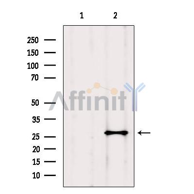 Валидация Affinity AF6080 - 3282