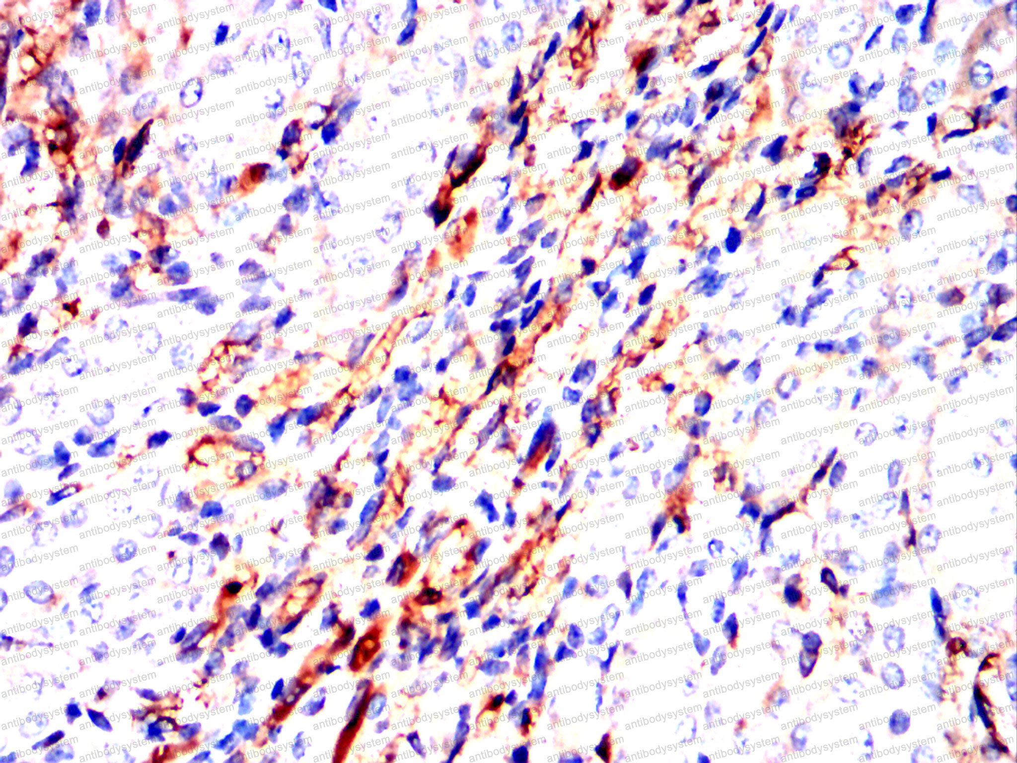 Валидация AntibodySystem RHD46601 (1591)