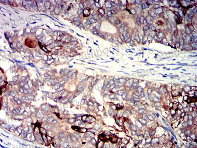 Валидация AntibodySystem RHB96102 (489)