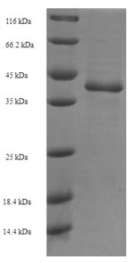 SDS-PAGE