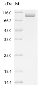 SDS-PAGE