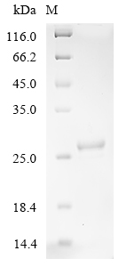SDS-PAGE