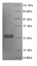 SDS-PAGE