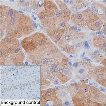 Валидация AntibodySystem RHC32501