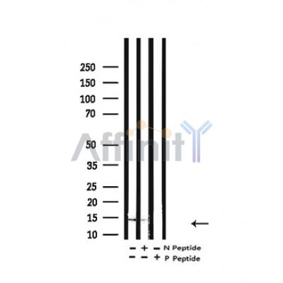 Валидация Affinity AF4356 - 2191