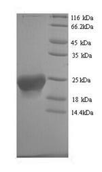 SDS-PAGE