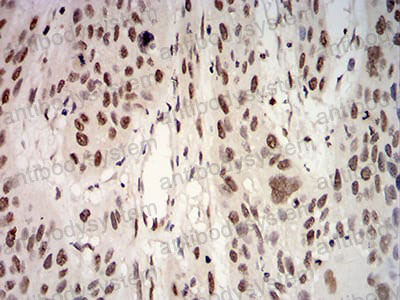 Валидация AntibodySystem RVV45001 (4211)