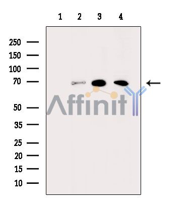 Валидация Affinity AF5491 - 3174