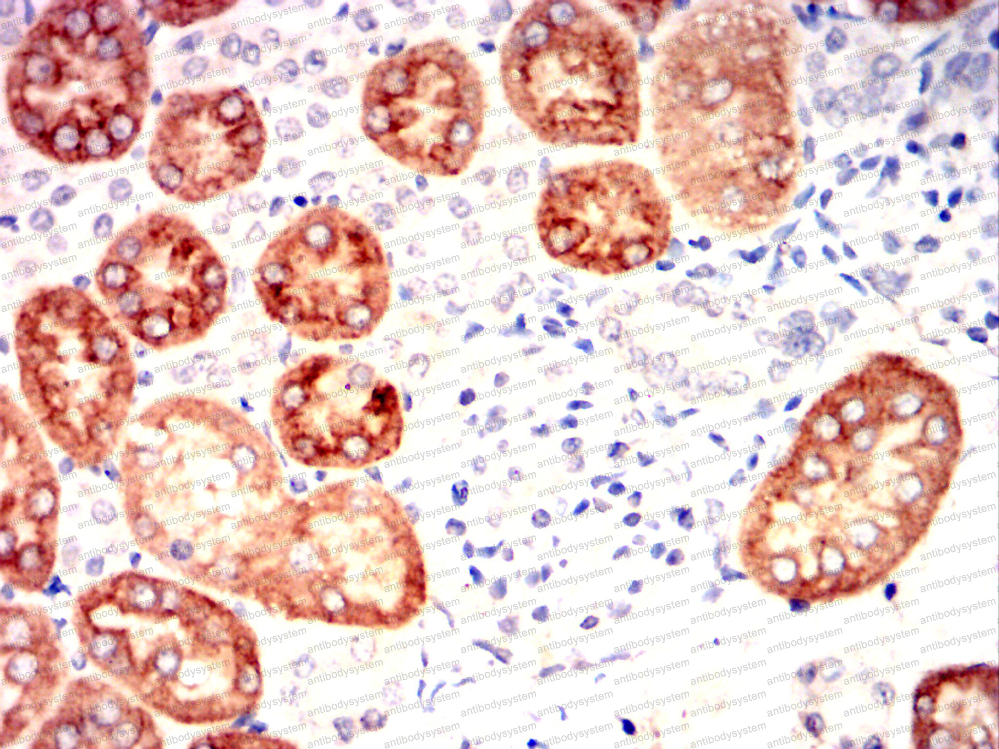 Валидация AntibodySystem RHA16101