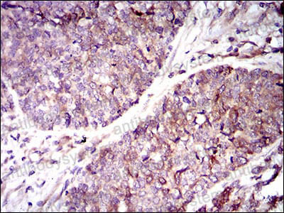 Валидация AntibodySystem RHF91702