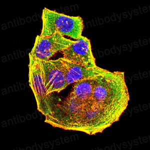 Валидация IF - AntibodySystem RHN97801