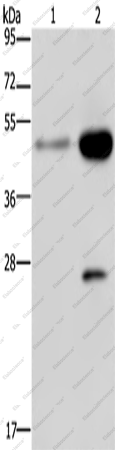 Вестерн-блоттинг, CD160, клетки 231 и HeLa