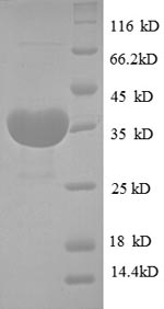 SDS-PAGE