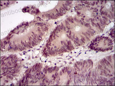 Валидация AntibodySystem RMN92801 (4189)