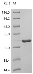 SDS-PAGE