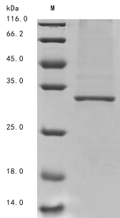 SDS-PAGE