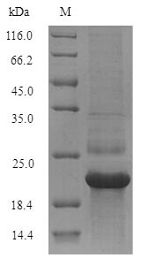 SDS-PAGE