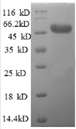 SDS-PAGE